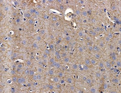 DNAH8 Antibody - DF15141 at 1/100 staining rat brain tissue by IHC-P.