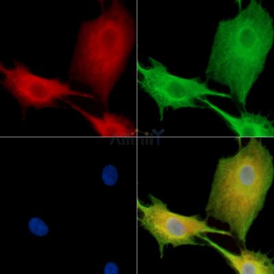 SLC6A7 Antibody - DF15142 staining A549 cells by IF/ICC.