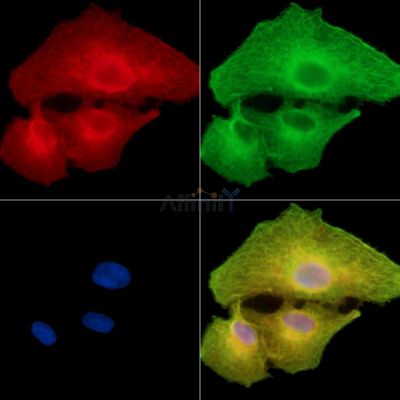 CEP85L Antibody - DF15145 staining A549 cells by IF/ICC.