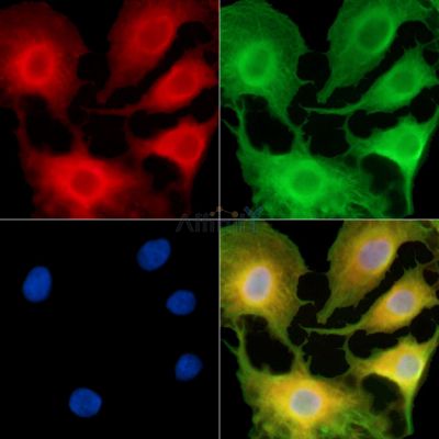 LRRC8C Antibody - DF15147 staining A549 cells by IF/ICC.