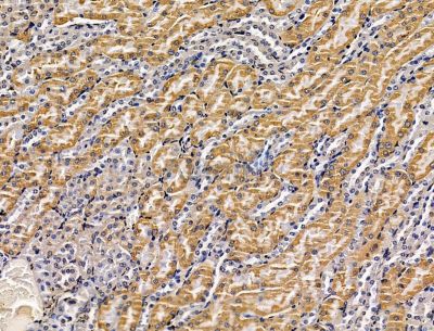 PKHD1 Antibody - DF15154 at 1/100 staining mouse kidney tissue by IHC-P.