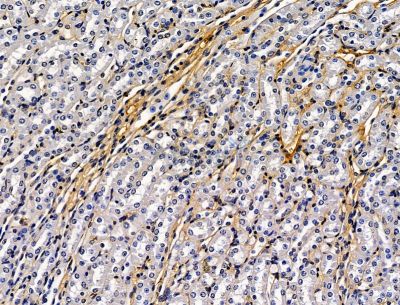 CPAMD8 Antibody - DF15155 at 1/100 staining mouse kidney tissue by IHC-P.