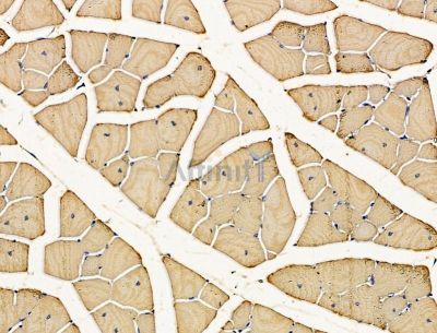 EPG5 Antibody - DF15156 at 1/100 staining mouse muscle tissue by IHC-P.