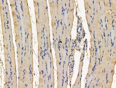 SDHAF4 Antibody - DF15161 at 1/100 staining rat muscle tissue by IHC-P.