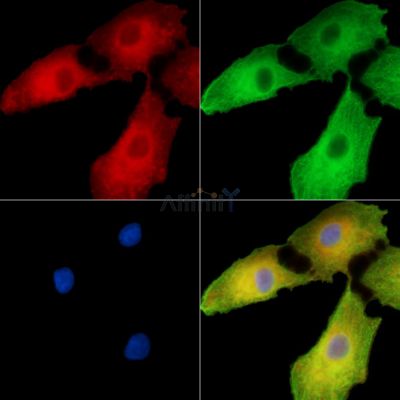 UQCC1 Antibody - DF15163 staining A549 cells by IF/ICC.