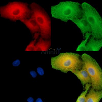 SLC25A43 Antibody - DF15164 staining A549 cells by IF/ICC.