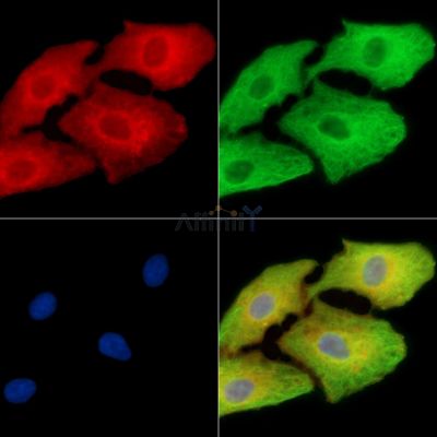 PARD3B Antibody - DF15165 staining A549 cells by IF/ICC.