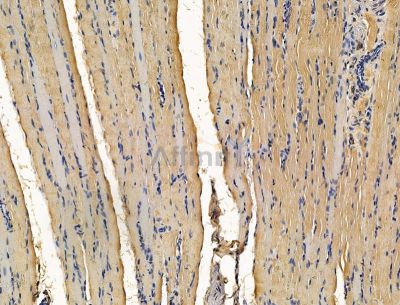TTC21B Antibody - DF15166 at 1/100 staining rat muscle tissue by IHC-P.