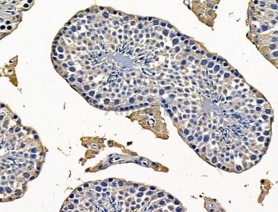 DMXL1 Antibody - DF15173 at 1/100 staining mouse testis tissue by IHC-P.