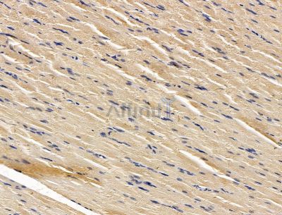 RNF145 Antibody - DF15174 at 1/100 staining rat muscle tissue by IHC-P.