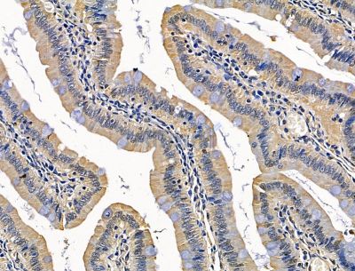 VWA5B2 Antibody - DF15176 at 1/100 staining rat colorectal tissue by IHC-P.