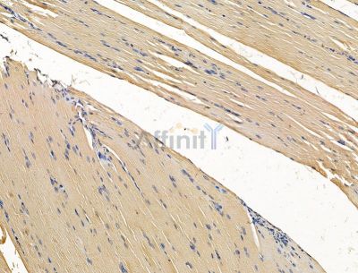 VWA5B2 Antibody - DF15176 at 1/100 staining rat muscle tissue by IHC-P.