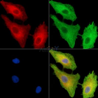 FRMD4A Antibody - DF15186 staining A549 cells by IF/ICC.