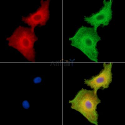 CEP295 Antibody - DF15190 staining A549 cells by IF/ICC.