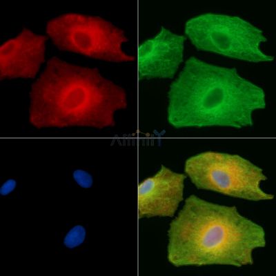 C10orf90 Antibody - DF15191 staining A549 cells by IF/ICC.