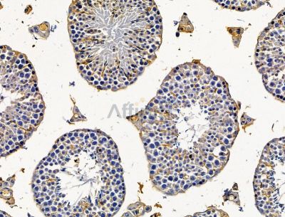 TSFM Antibody - DF15206 at 1/100 staining mouse testis tissue by IHC-P.