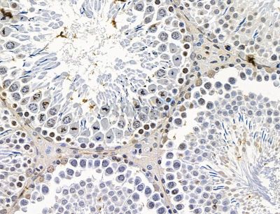 DLX1 Antibody - DF15207 at 1/100 staining rat testis tissue by IHC-P.