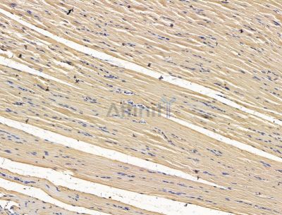 FABP12 Antibody - DF15211 at 1/100 staining rat muscle tissue by IHC-P.