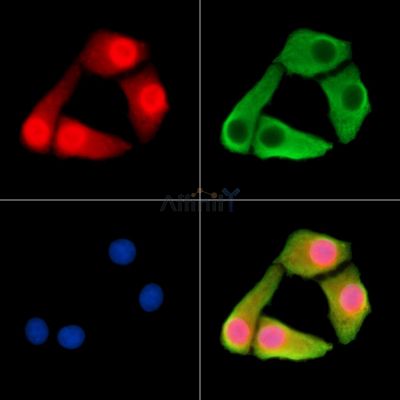 WWC2 Antibody - DF15212 staining Hela cells by IF/ICC.