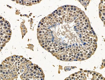 WWC2 Antibody - DF15212 at 1/100 staining mouse testis tissue by IHC-P.