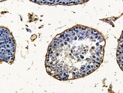 JADE3 Antibody - DF15229 at 1/100 staining mouse testis tissue by IHC-P.