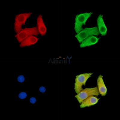 OR4K17 Antibody - DF15237 staining Hela cells by IF/ICC.