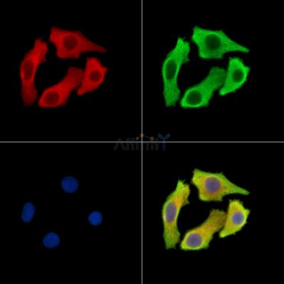 CRELD1 Antibody - DF15244 staining Hela cells by IF/ICC.