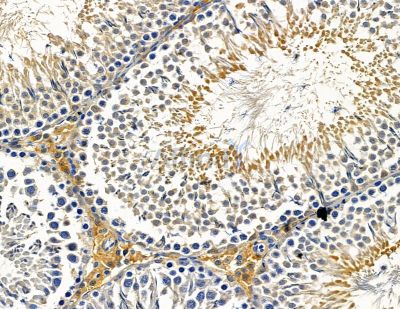 LCE3C Antibody - DF15258 at 1/100 staining rat testis tissue by IHC-P.