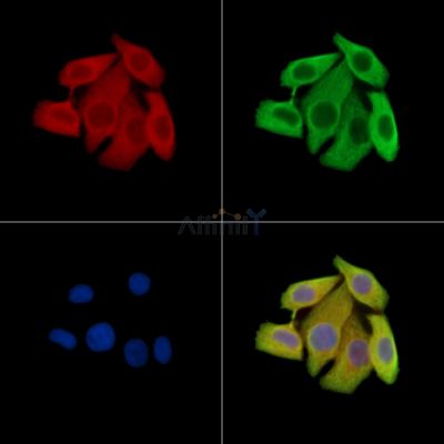 PACSIN1 Antibody - DF15266 staining Hela cells by IF/ICC.