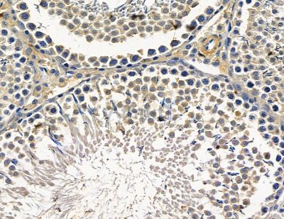 DSTN Antibody - DF15268 at 1/100 staining rat testis tissue by IHC-P.