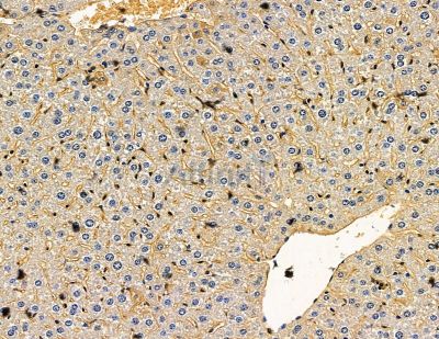 SLC25A22 Antibody - DF15269 at 1/100 staining mouse liver tissue by IHC-P.