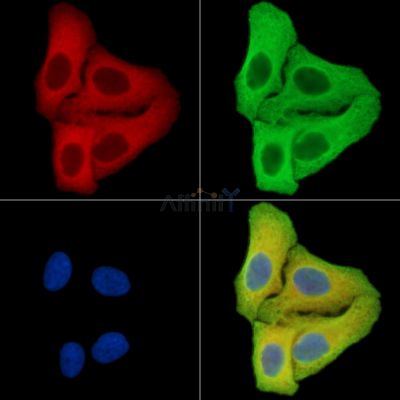 SMYD5 Antibody - DF15270 staining Hela cells by IF/ICC.