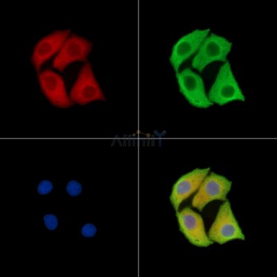 LMAN2 Antibody - DF15271 staining Hela cells by IF/ICC.
