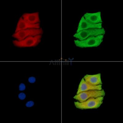 TRIB1 Antibody - DF15274 staining Hela cells by IF/ICC.