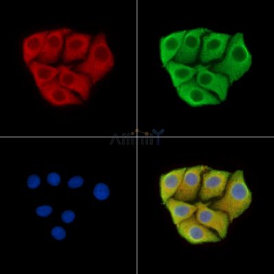 TP53AP1 Antibody - DF15277 staining Hela cells by IF/ICC.