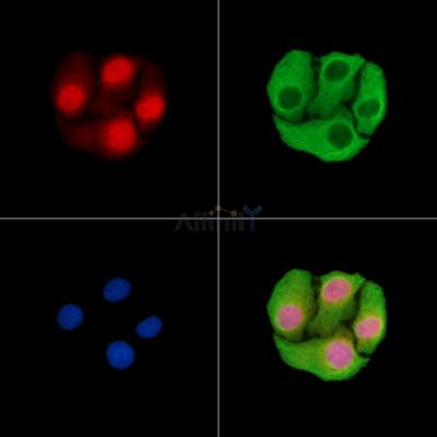 MYT1L Antibody - DF15285 staining Hela cells by IF/ICC.