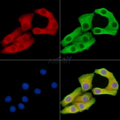 VPS13B Antibody - DF15286 staining Hela cells by IF/ICC.
