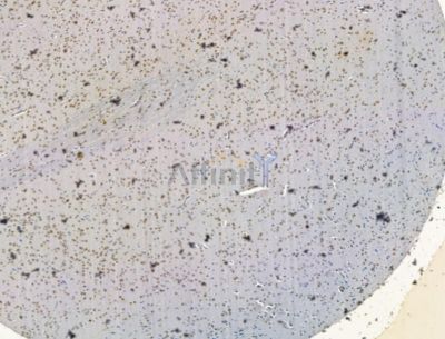 SELENOK Antibody - DF15288 at 1/100 staining rat brain tissue by IHC-P.