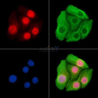 MIR22HG Antibody - DF15292 staining Hela cells by IF/ICC.