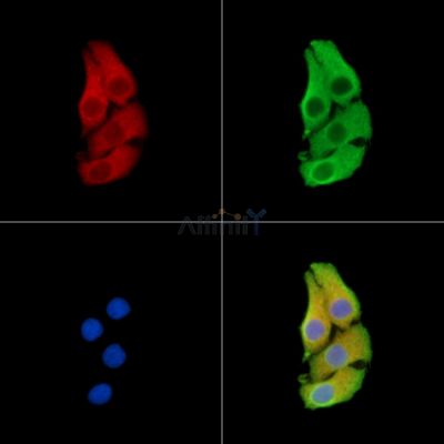 FAM210B Antibody - DF15302 staining Hela cells by IF/ICC.