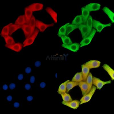 PLPP4 Antibody - DF15304 staining Hela cells by IF/ICC.