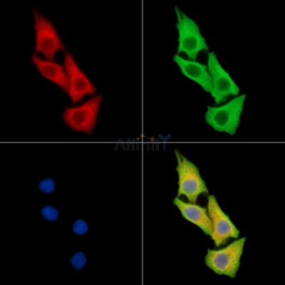 COLGALT1 Antibody - DF15311 staining Hela cells by IF/ICC.