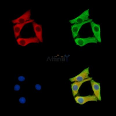 TOMM5 Antibody - DF15313 staining Hela cells by IF/ICC.
