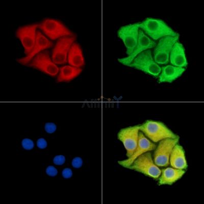 SLC34A1 Antibody - DF15316 staining Hela cells by IF/ICC.