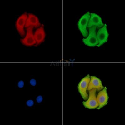 EML1 Antibody - DF15323 staining Hela cells by IF/ICC.