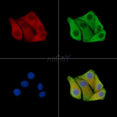 TMOD3 Antibody - DF15342 staining Hela cells by IF/ICC.