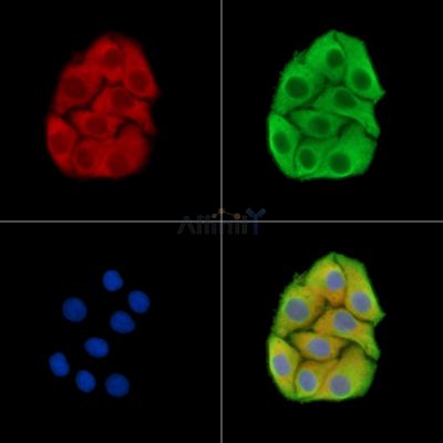 PDK3 Antibody - DF15350 staining Hela cells by IF/ICC.