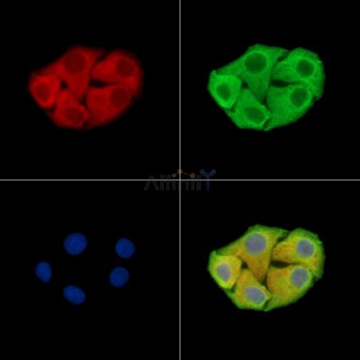 GRAMD1B Antibody - DF15353 staining Hela cells by IF/ICC.