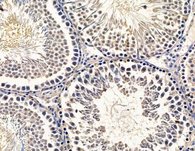GRAMD1B Antibody - DF15353 at 1/100 staining rat testis tissue by IHC-P.