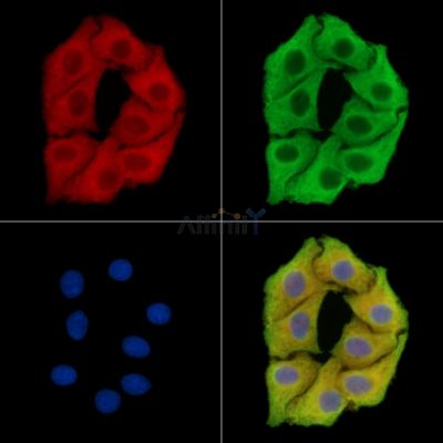 SPG7 Antibody - DF15355 staining Hela cells by IF/ICC.